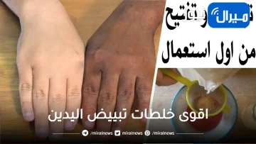 اقوى خلطات تبييض اليدين في خمس دقايق وصفه رهيييبة