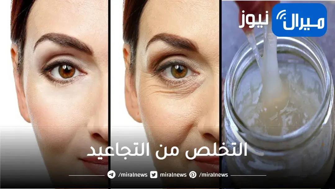 وداعا للبوتوكس.. طرق طبيعية سهلة ورخيصة التخلص من التجاعيد والنتيجة بعد 4 أيام