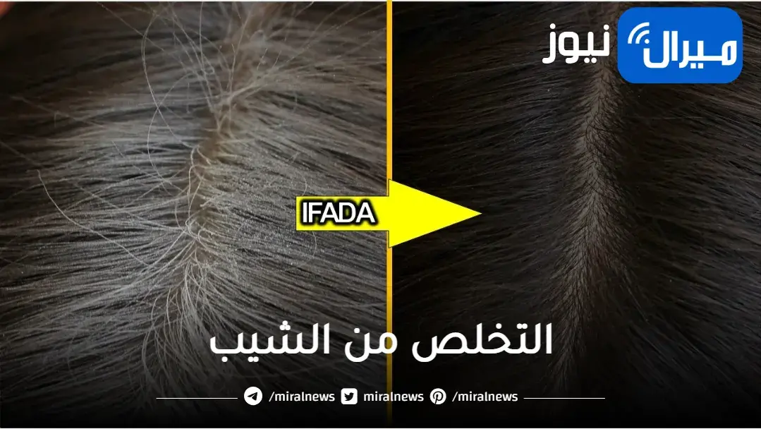 لشباب دائم.. التخلص من الشيب بوصفات طبيعية لشعر كسواد الليل وكوني أصغر 10 سنوات