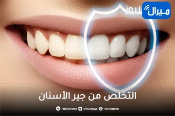 أسنانك هتلمع من تاني.. وصفات سحرية للقضاء نهائيًا على جير الأسنان