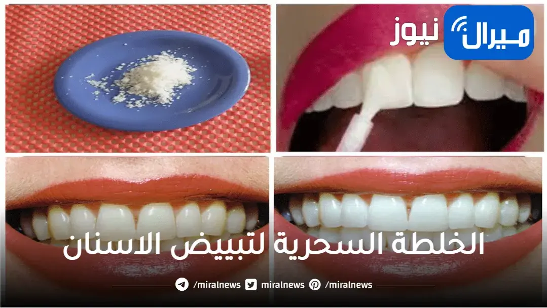 أسنان كالؤلؤ في يومين.. خلطة تبيض الاسنان والتخلص من الجير والتكلسات في منزلك بدون طبيب