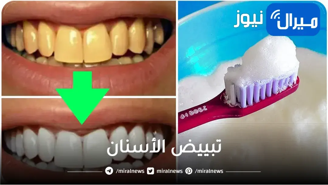 أسنانك زي اللؤلؤ.. اكتشاف خلطة جديدة لتبييض الاسنان في المنزل بكل سهولة وبدون أي مواد كيميائية
