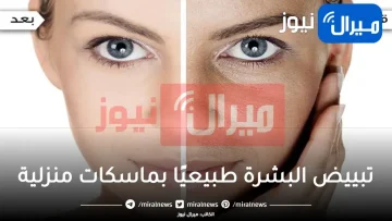 تبييض البشرة طبيعيًا بماسكات منزلية للتخلص من الشوائب والبقع الداكنة