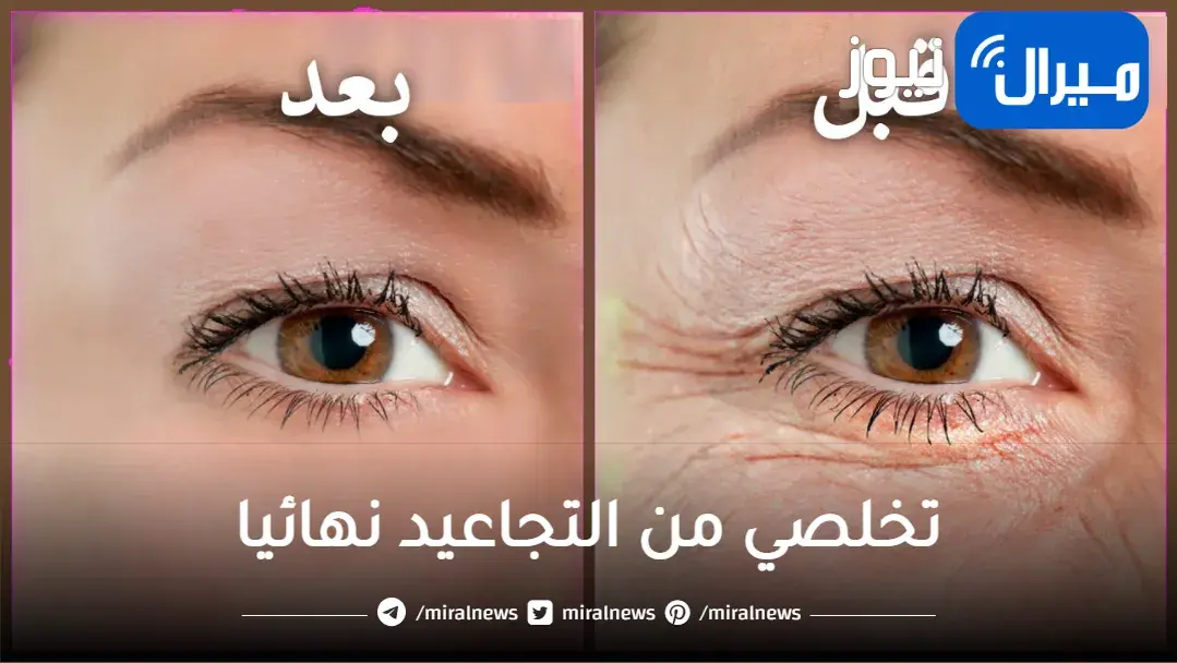 ارجعي شباب تاني.. تخلصي من التجاعيد نهائيا بمكونات موجودة في كل بيت وشوفي النتيجة بنفسك
