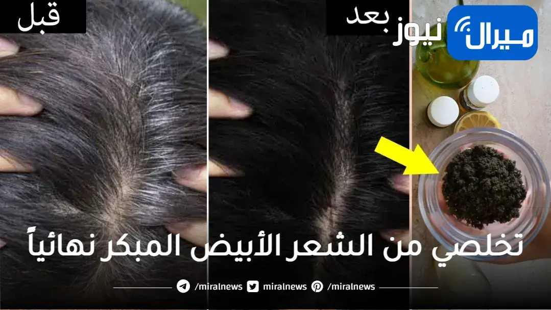 تخلصي من الشعر الأبيض المبكر نهائياً بمعلقة واحدة من الفازلين السحري ورجعي شبابك من جديد