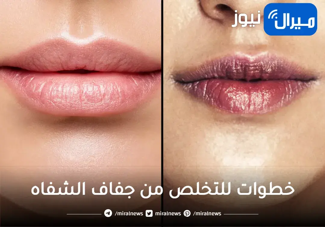 خطوات للتخلص من جفاف الشفاه