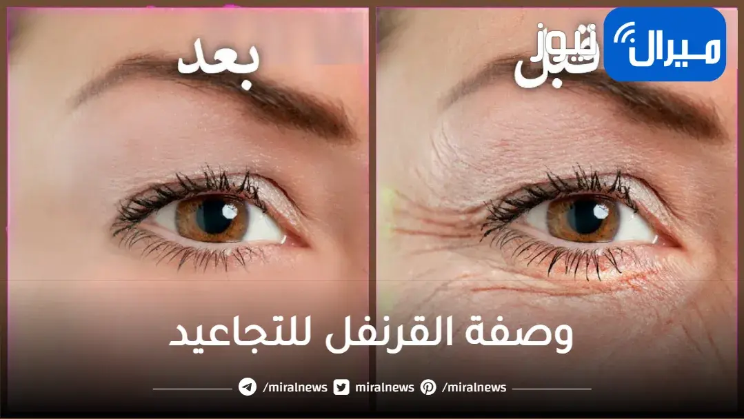 متفكريش في سنك.. كريم القرنفل للتجاعيد وعلامات تقدم السن وكوني أصغر 7 سنوات