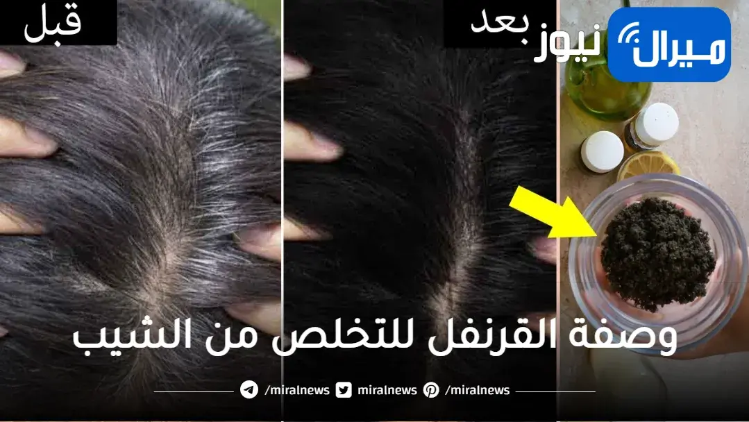 أسرار وصفة القرنفل للتخلص من الشيب بطريقة سهلة في المنزل