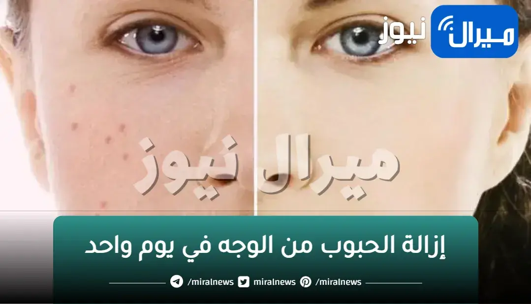 اسرع وصفة لإزالة الحبوب من الوجه في يوم واحد مجربة ومضمونة 100%