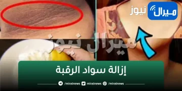 أفضل وصفة للتخلص من سواد العنق والأكواع والركب بمكونات طبيعية