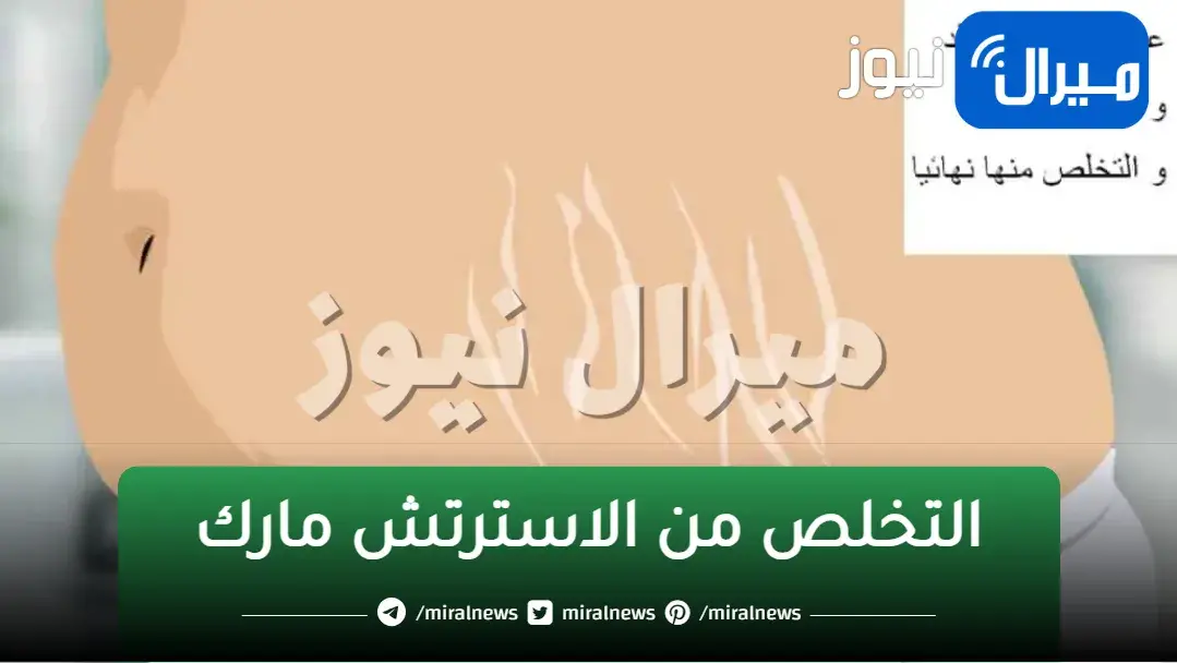 للتخلص من الاسترتش مارك.. 5 وصفات طبيعية داخل المنزل