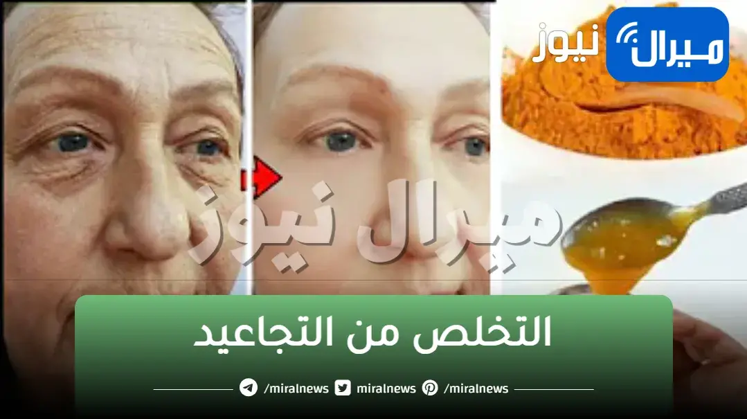 طريقة سحرية في التخلص من التجاعيد باستخدام الكركم والفازلين
