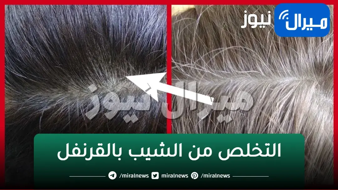 التخلص من الشيب بالقرنفل انسي أي شعر أبيض في رأسك وارجعي شباب