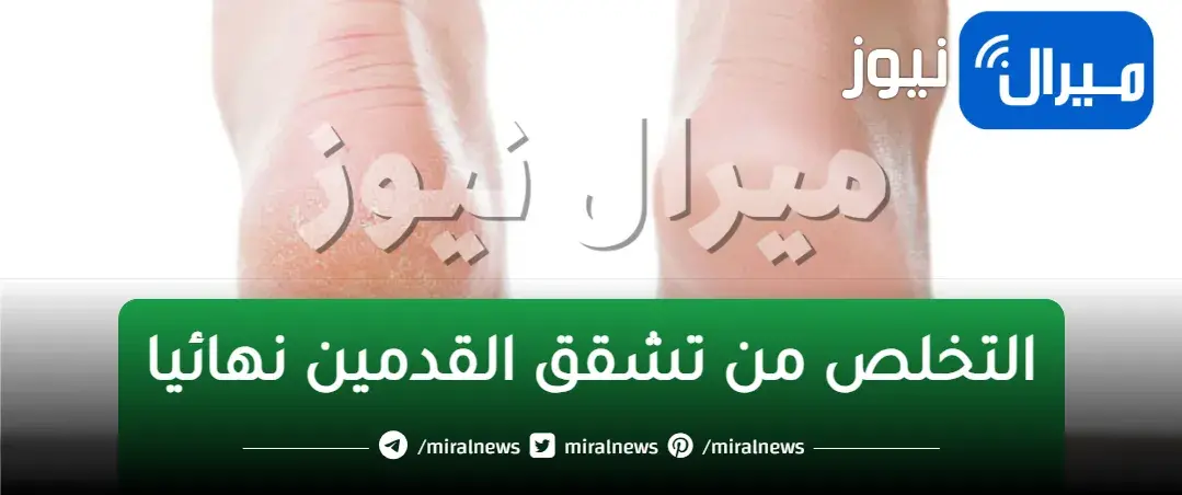 كريم طبيعي من الفازلين والنشا للتخلص من تشققات القدمين نهائياً