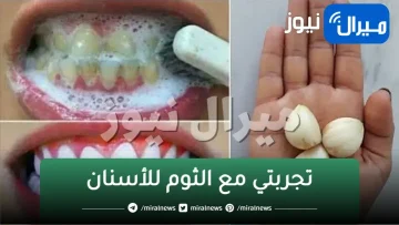 الثوم السر وراء أسنان هوليوود ناصعة البياض… مكون جبار سهل وبسيط ومتوفر في كل بيت