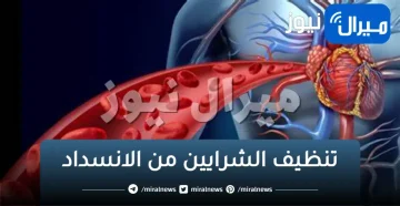 تنظيف الشرايين من الانسداد والدهون.. ستخرج من شرايينك دهون السنين للحصول على صحة حديد سبحان الله