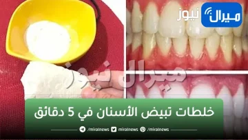 بمكون سحرى في منزلك ستحصلين على أسنان بيضاء وناصعة