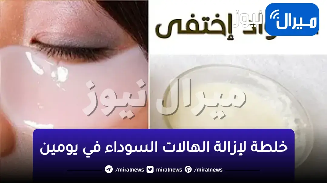 وصفة سحرية لإزالة الهالات السوداء في يومين بمكون واحد