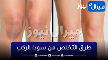 طرق التخلص من سواد الركب في يوم واحد فقط بمكونات طبيعية