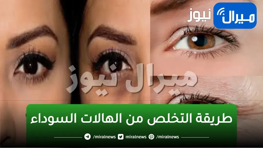 وصفة جهنمية لإخفاء الهالات السوداء تحت العين والتجاعيد بسهولة في المنزل وأفضل من البيوتي سنتر
