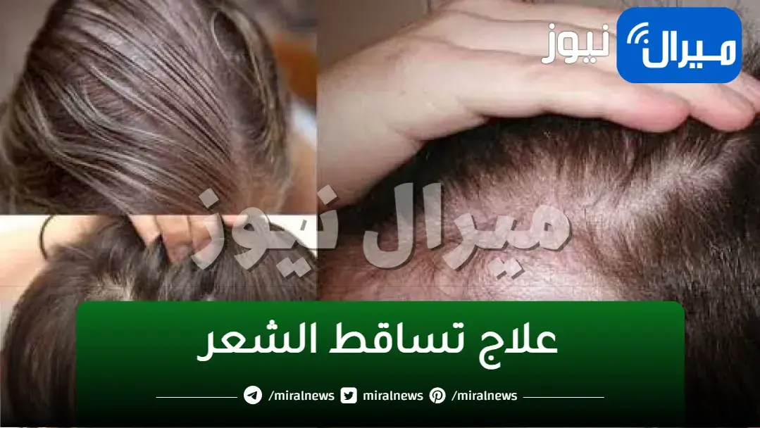 طرق طبيعيه وفعاله لعلاج تساقط الشعر وزيادة كثافة وفي وقت قياسي