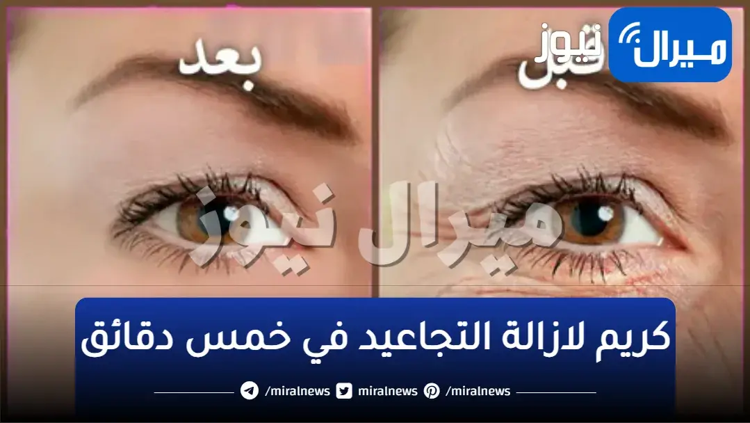 بوتوكس طبيعي في علبة .. أقوى كريم سحري لإخفاء تجاعيد الجبهة وحول العين في 7 أيام فقط