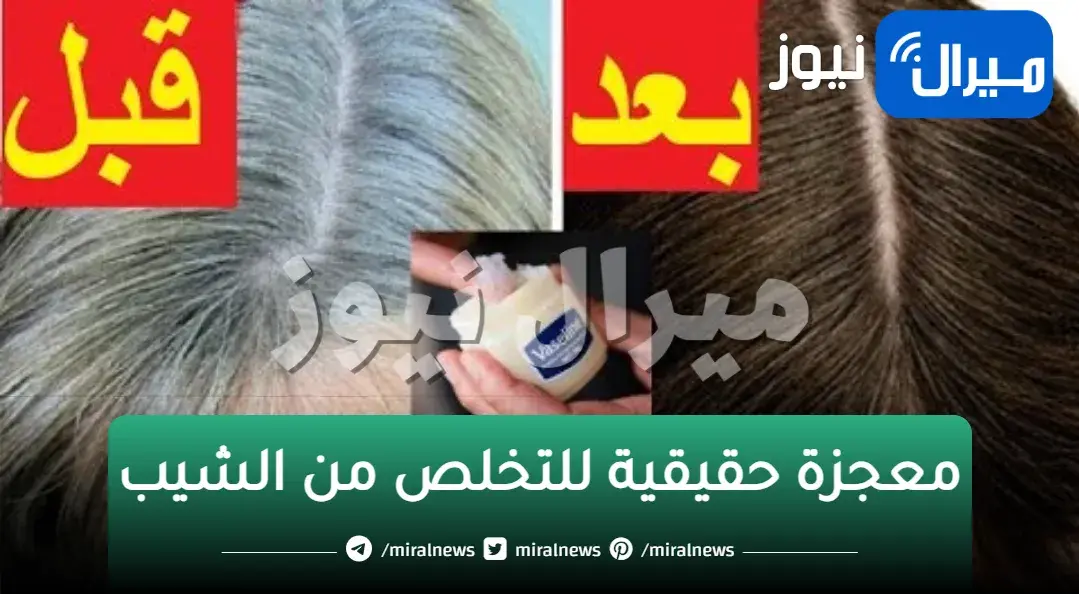معجزة حقيقية للتخلص من الشيب في يومين مع إنهاء كافة مشكلات وأزمات الشعر