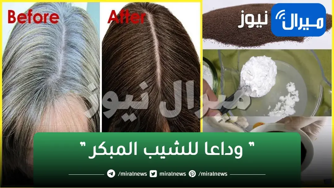 ” وداعا للشيب المبكر ” وصفة الملح للقضاء على الشعر الأبيض والشيب نهائيا بدون أي مواد كيماوية في دقائق معدودة