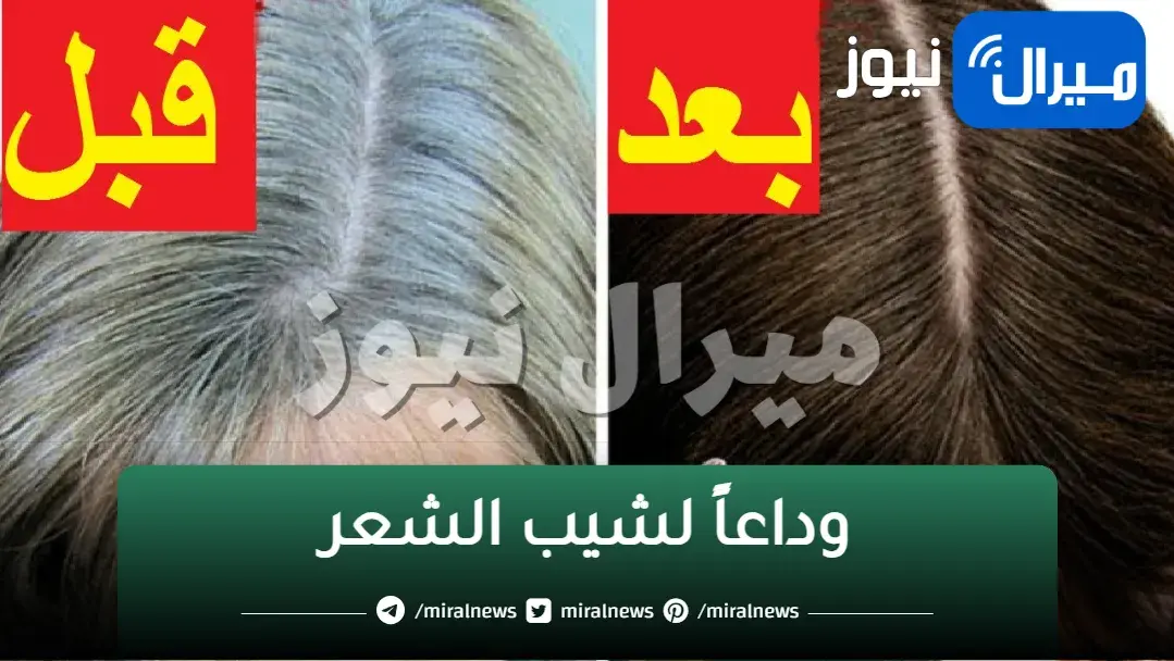 وداعاً لشيب الشعر.. بملعقة ملح تخلصي من الشيب المبكر نهائيا في ثواني معدودة بدون صبغات كيميائية