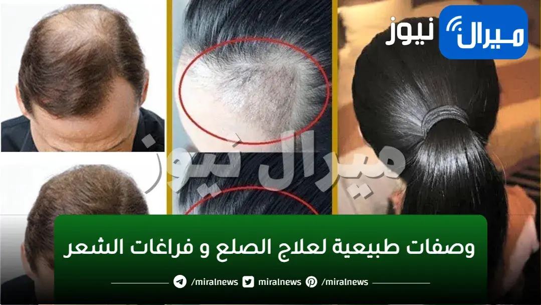 ضعيه على شعرك لمدة 7 أيام لانبات وملئ فراغات الشعر وتطويله وتكثيفه بدون توقف وبسرعة الصاروخ
