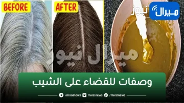 أقوى الوصفات الطبيعية للتخلص من الشيب المبكر بمكونات منزلية