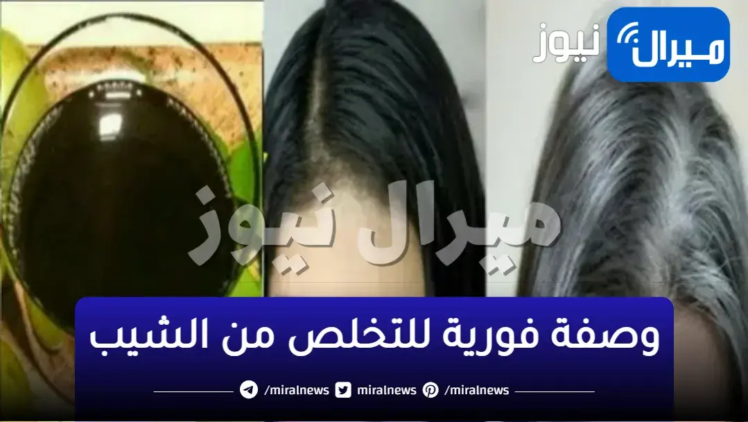 وصفة فورية للتخلص من الشيب الأبيض في أقل من شهر تخلصي تماماً من الشعر الأبيض وظهوره المبكر