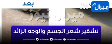 طرق سريعة وطبيعية لتشقير شعر الجسم والوجه الزائد.. تخلصي من الإحراج في أقل وقت وبأقل مجهود