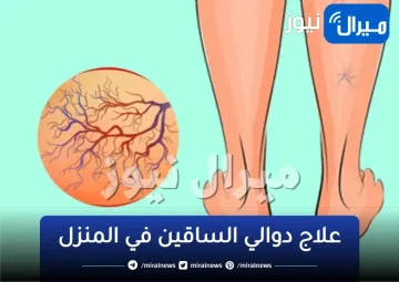التخلص من مشكلة الدوالي في أقل مدة ممكنة