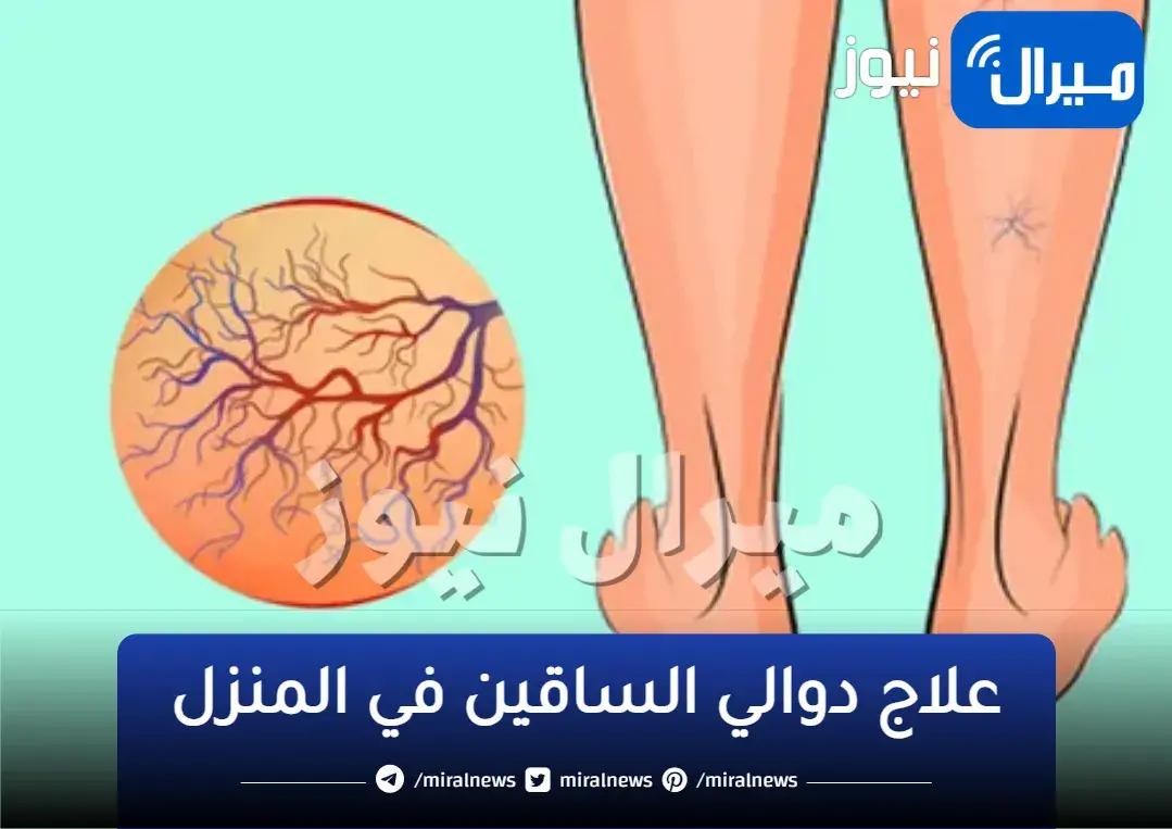 التخلص من مشكلة الدوالي في أقل مدة ممكنة