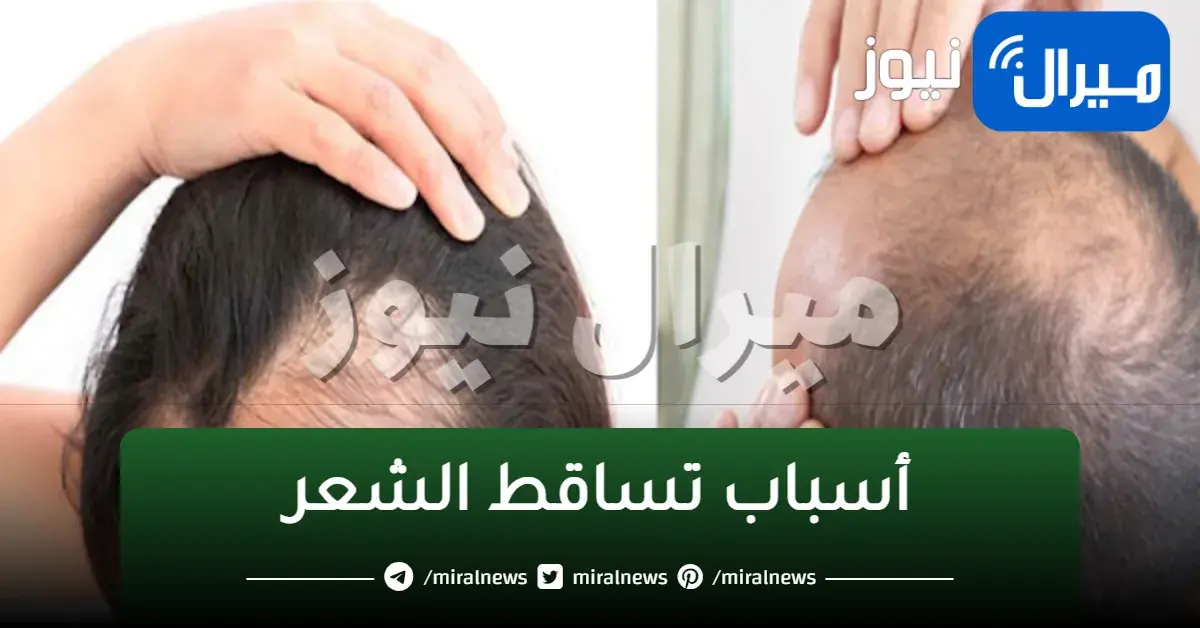 اسباب تساقط الشعر عند النساء والشباب وطرق علاجه