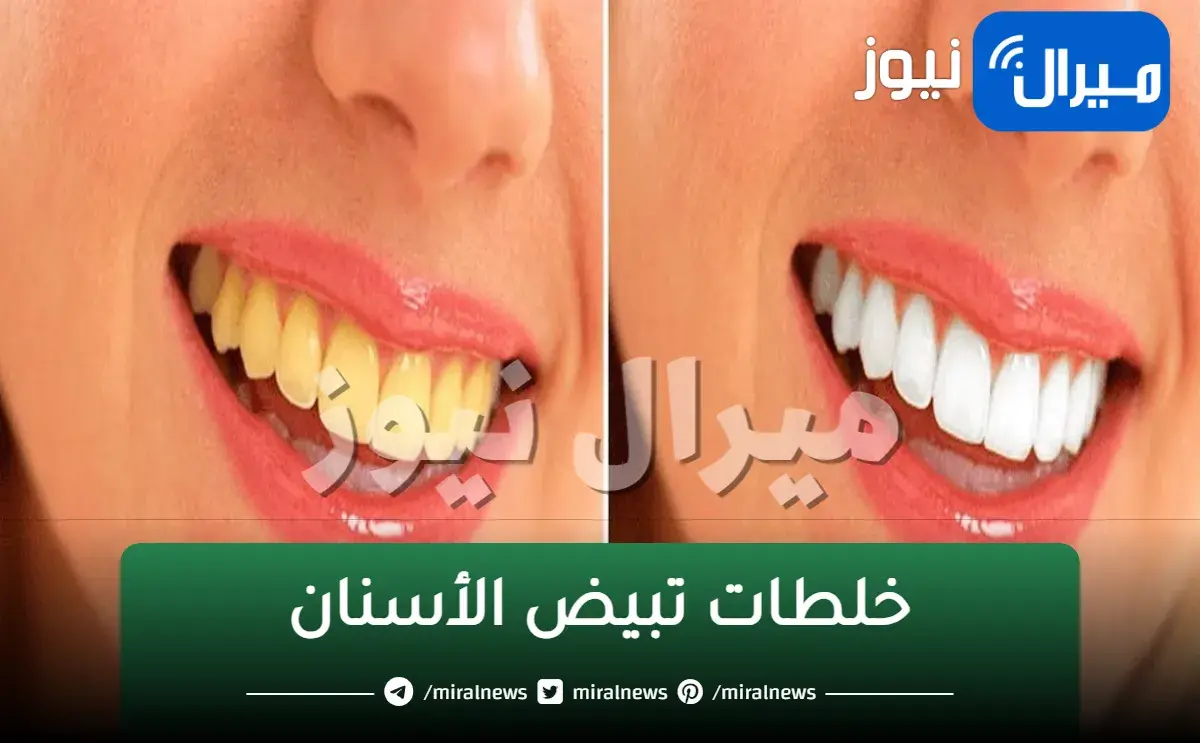 في 5 دقائق..خلطات تبيض الأسنان فى المنزل بمكونات اقتصادية