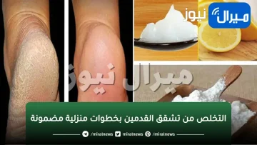 بخطوات منزلية مضمونة|طريقة العناية بالقدمين والتخلص من التشققات