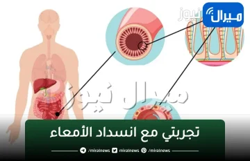 تجربتي مع انسداد الأمعاء