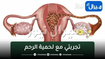 تجربتي مع لحمية الرحم