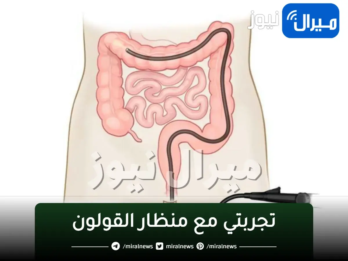 تجربتي مع منظار القولون