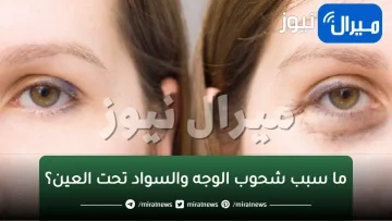 ما سبب شحوب الوجه والسواد تحت العين؟