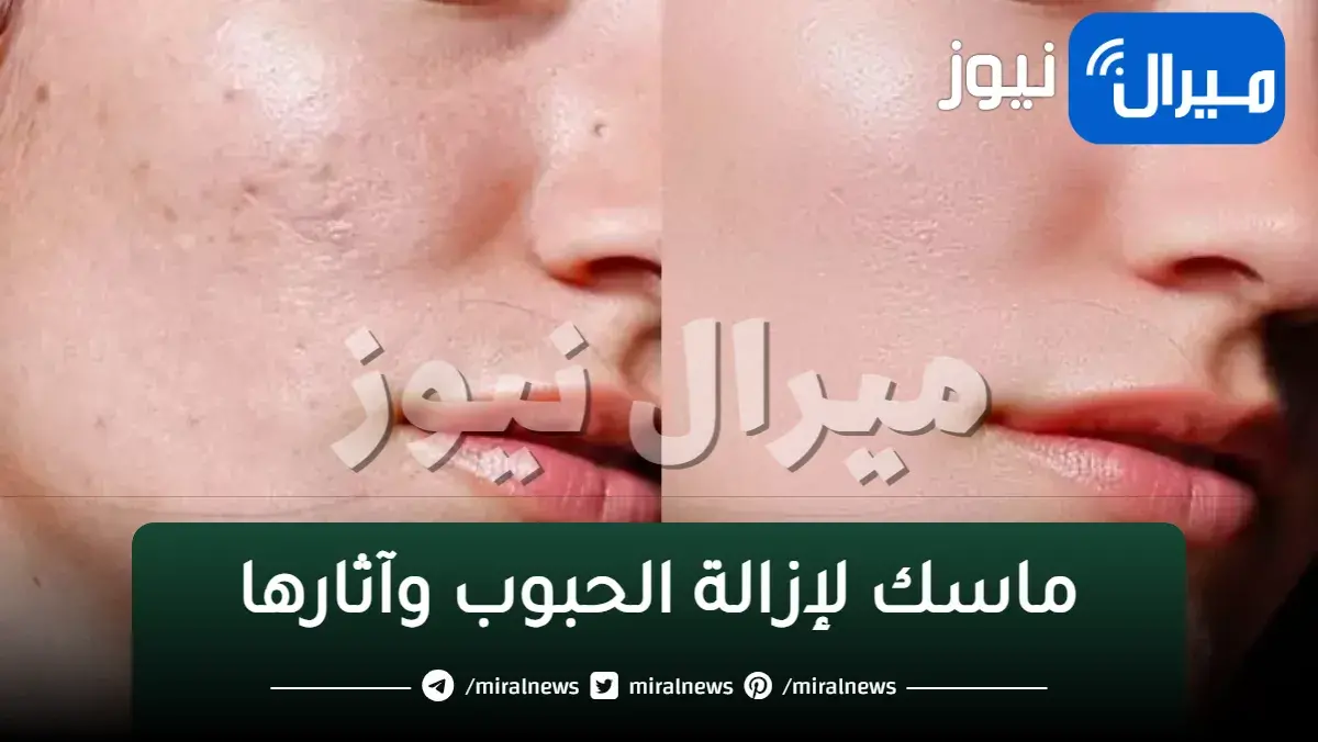 ماسك لإزالة الحبوب وآثارها