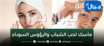 ماسك لحب الشباب وإزالة الرؤوس السوداء في يوم واحد من أول استعمال