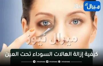 “لن تحتاج الى الكريم” أسرع طريقة للتخلص من الهالات السوداء والترهل والتجاعيد تحت العين