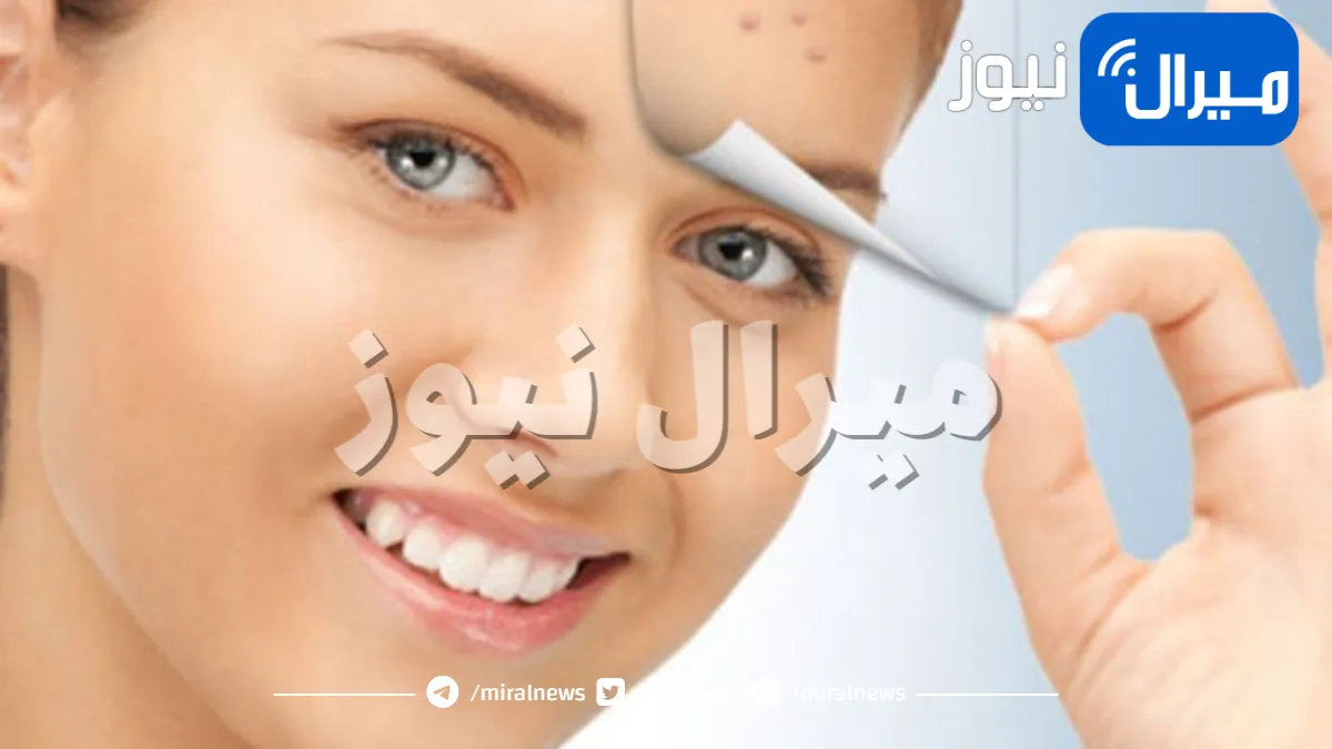 مكون جبار لعلاج حب الشباب للبشرة الدهنية طبيعياً في المنزل وبدون عودة
