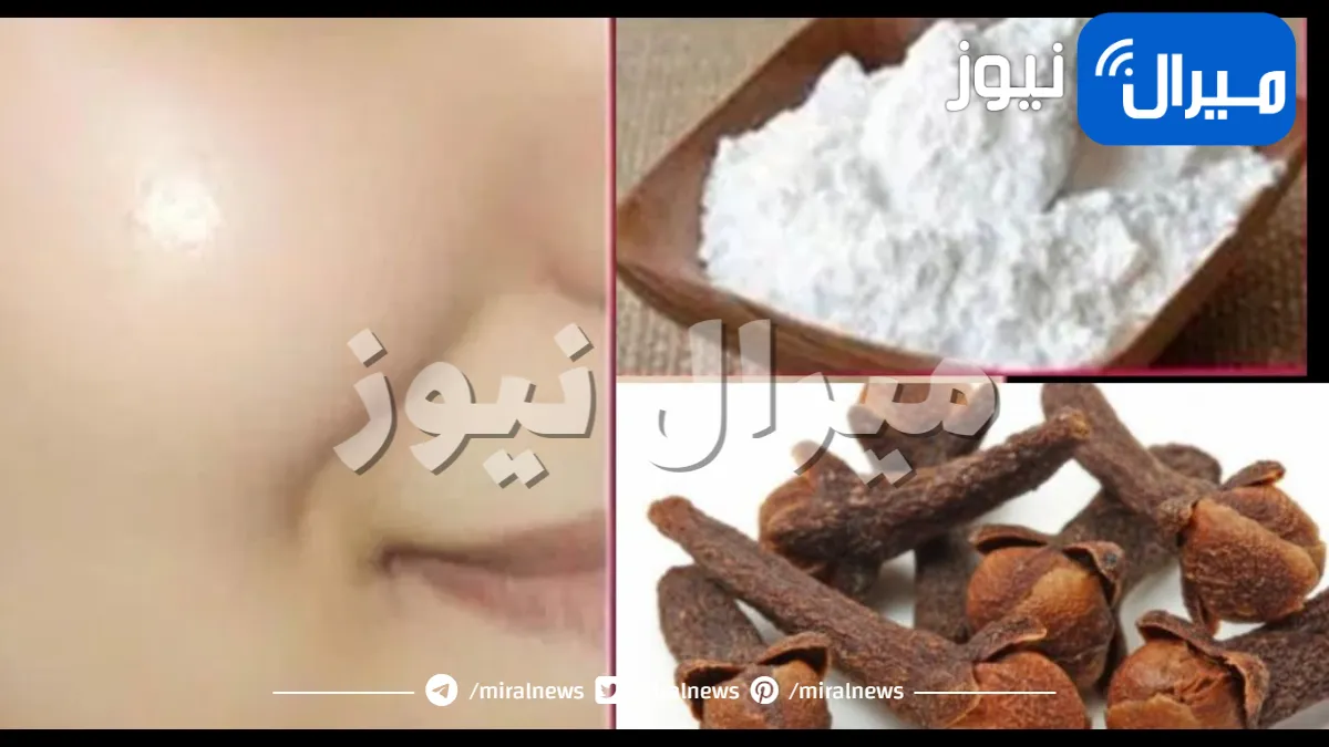 اعملي كريم النشا والقرنفل للقضاء على اسمرار البشرة وإزالة التجاعيد بشكل نهائي.. في المنزل بمكونات اقتصادية