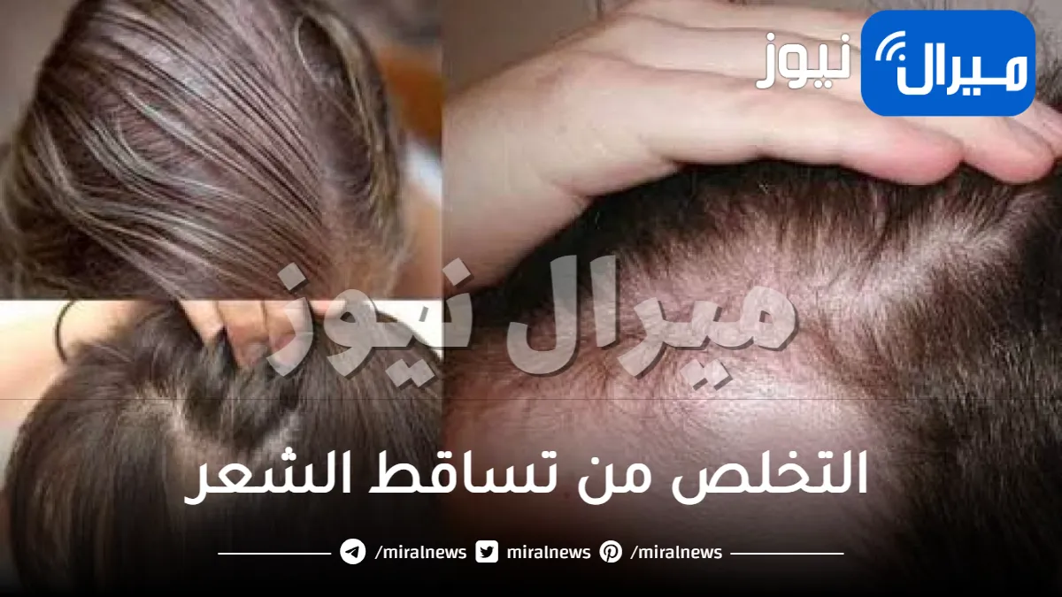طريقة التخلص من تساقط الشعر بوصفات طبيعية ومذهلة ونتائجها سريعة