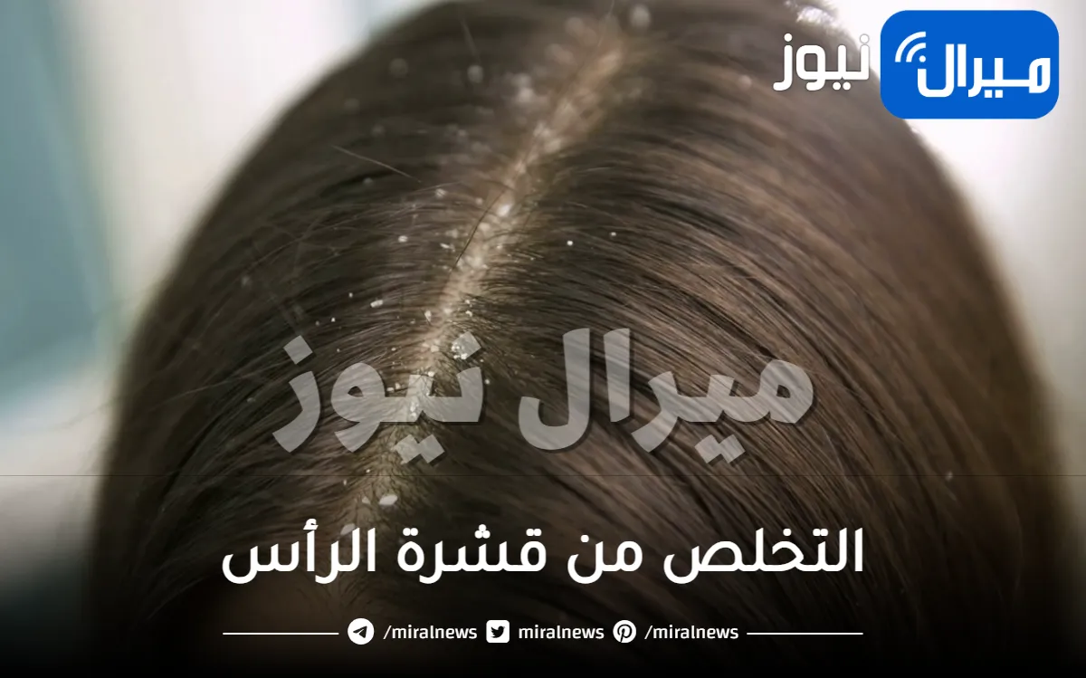 وداعا للإحراج.. دلكي بهذا المكون السحري شعرك وتخلصي من قشرة الشعر والحكة نهائياً ومن أول مرة