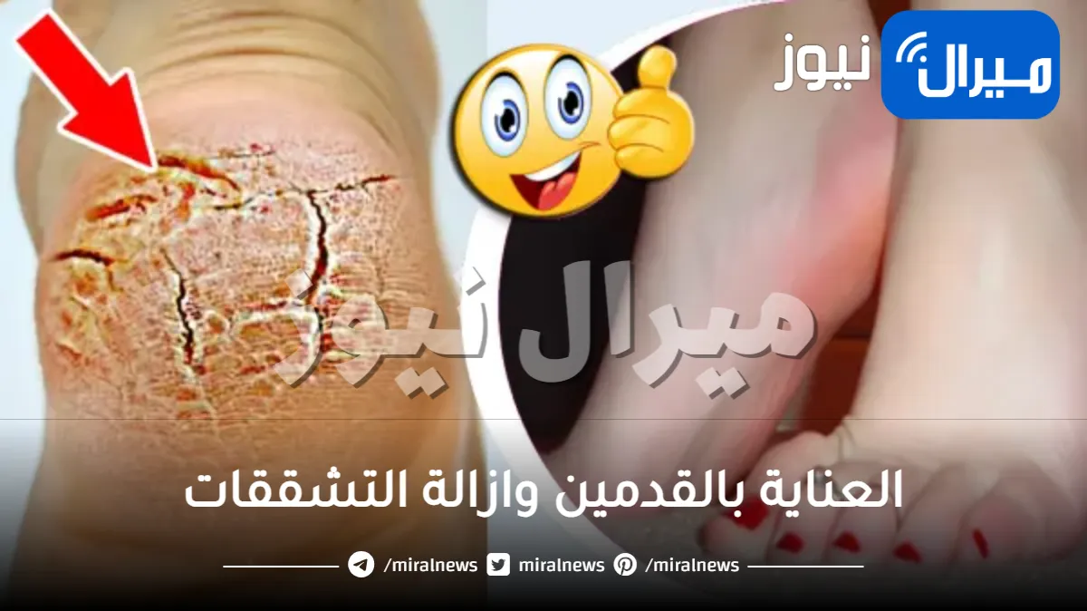 طريقة ذكية لتقشير القدمين وازالة التشققات بطريقة بسيطة وسريعة تجلعها وردية وحرير .. والسر بهذا المكون المعجزة